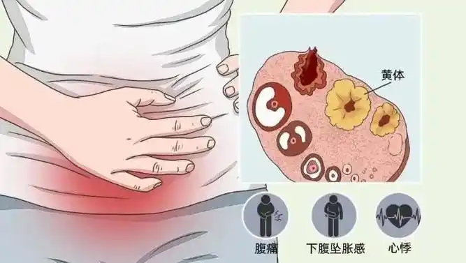 卵巢破裂的症状有哪些